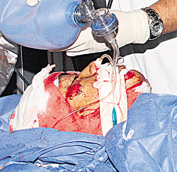haga click para ampliar la imagen