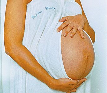 Imagen foto