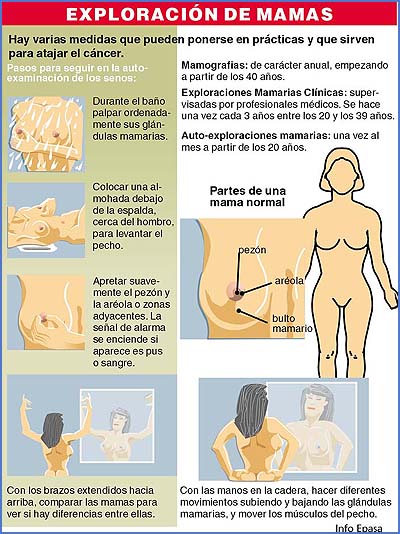 Imagen foto