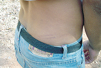 Imagen foto