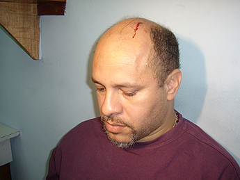 Imagen foto