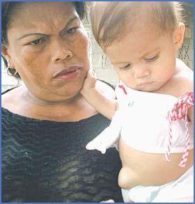 Imagen foto