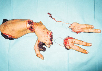 haga click para ampliar la imagen