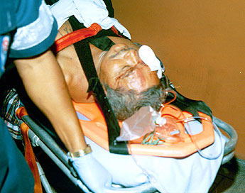 Imagen foto