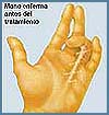 Imagen foto
