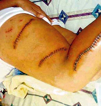 Imagen foto