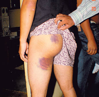 Imagen foto