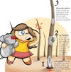 Imagen foto