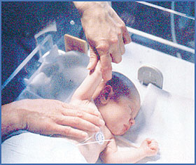 Imagen foto