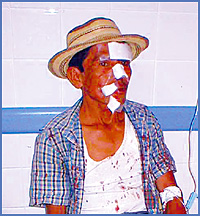 Imagen foto