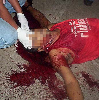 Imagen foto