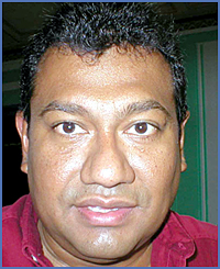 Imagen foto