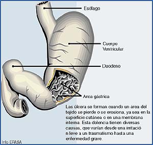 Imagen foto