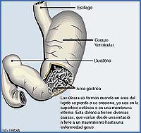 Imagen foto