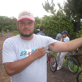 Imagen foto