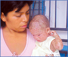 Imagen foto