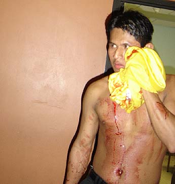 Imagen foto