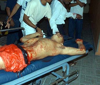 Imagen foto