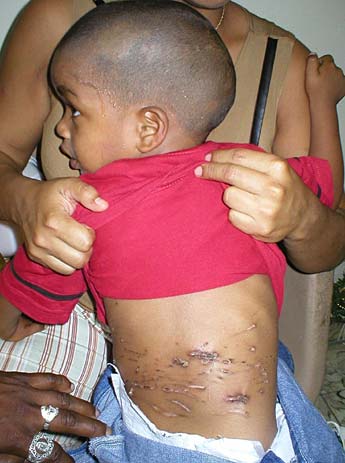 Imagen foto