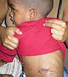 Imagen foto