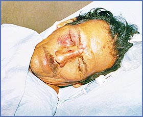 Imagen foto
